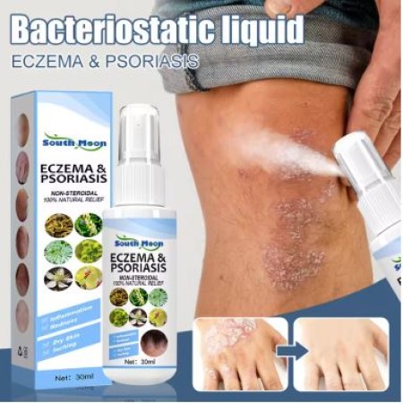 Natural Herb Eczema Psoriasis Treatment Spray