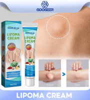 Lipoma নিরাময়ের Ointment(লিপোমা/ফুলে উঠা)