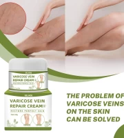 Varicose Veins Cream