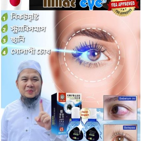 Eye Drops (সমস্ত চোখের-সম্পর্কিত সমস্যা সমাধান করুন)