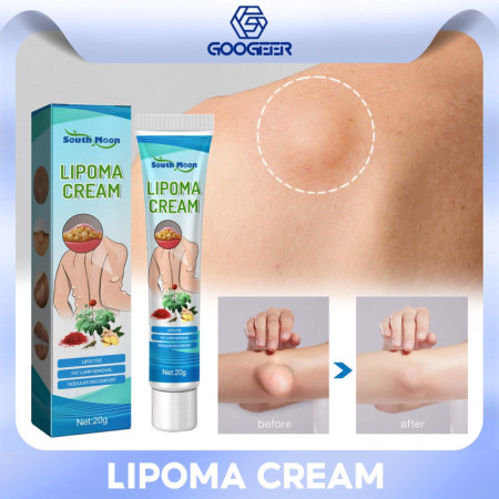 Lipoma নিরাময়ের Ointment(লিপোমা/ফুলে উঠা)