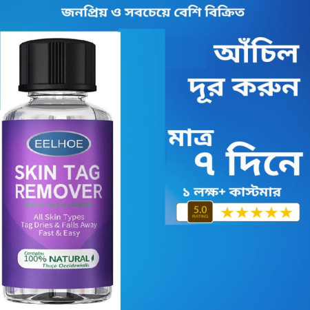 Wart Remover 30 ML