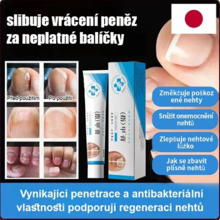 Nail treatment cream — ফাঙ্গাস, পুঁজ ও রক্ত পড়া সহ নখের সমস্যায় কার্যকর ক্রিম (২০ গ্রাম)