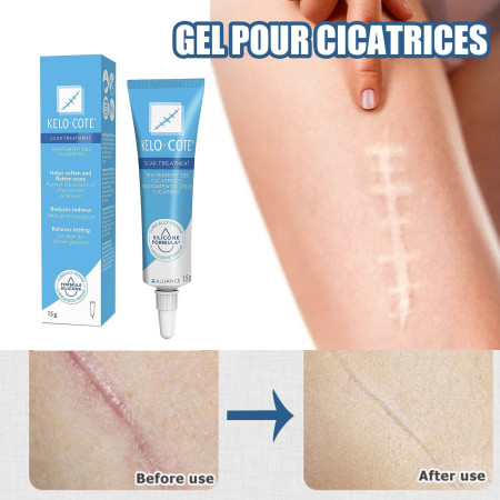 KELO-COTE® Scar Gel – Clinically Proven Scar Treatment