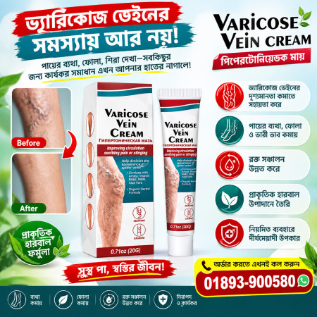 Varicose Veins Treatment Cream
